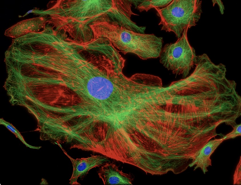 This is an image of a florescent molecule.